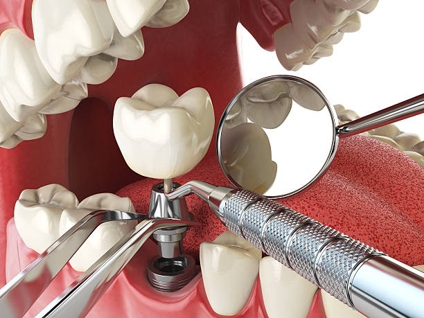 Best Emergency Broken Tooth Repair in Williamstown, KY